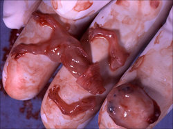 8 week abortion.jpg